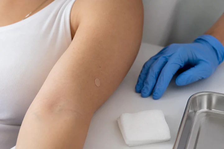 Nexplanon vs. Implanon
